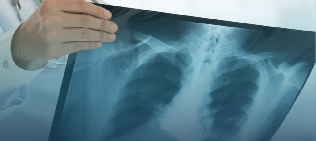 Health Express Urgent Care X Rays
